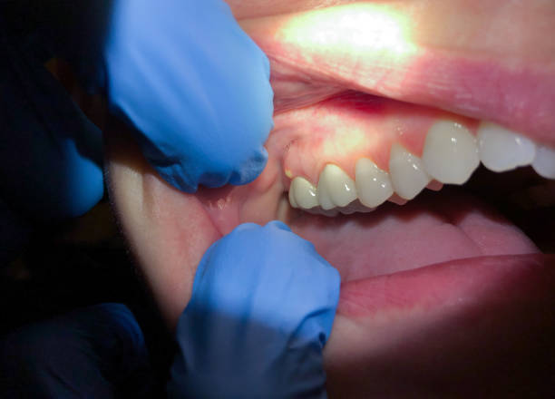 Best Emergency Dental Surgery in Harleigh, PA